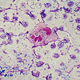 Bacteria Pseudomonas aeruginosa infectando el torrente sanguíneo. Foto: Wikipedia